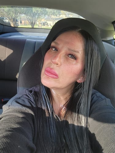 Customer photo review of Face & Neck Firming Duo with Cold Plasma Sub-D+