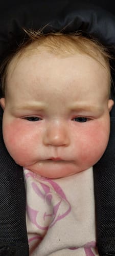 Customer photo review of Kokoso Baby® Coconut Oil