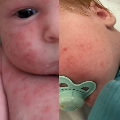 Customer photo review of Kokoso Baby® Coconut Oil