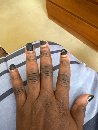 Customer photo review of Lightening Water Treatment (For Dark Hands & Feet)