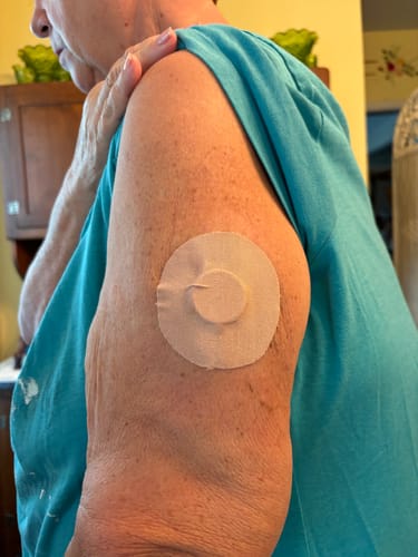 Customer photo review of Skin Grip Original - Freestyle Libre 2 Adhesive Patches - 20 Pack