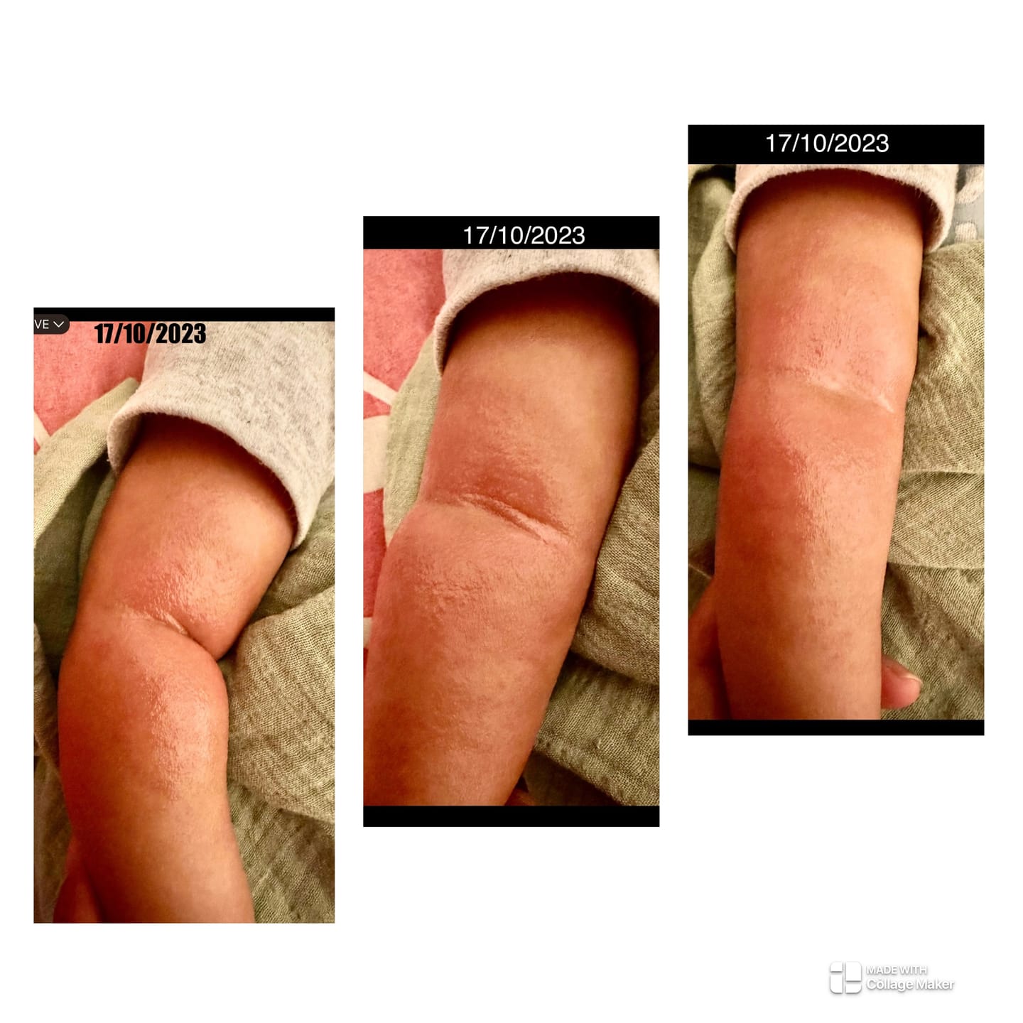 Customer photo review of Kawakawa Repair Balm