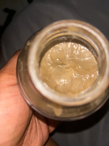 Customer photo review of Extreme Dark Hands Feet Knees And Elbows Repair Cream