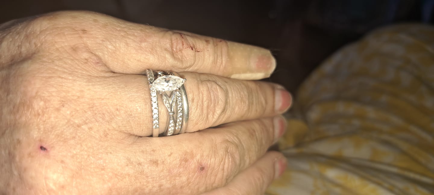 Customer photo review of Marquise Cut Moissanite Petals Split Shank Engagement Ring