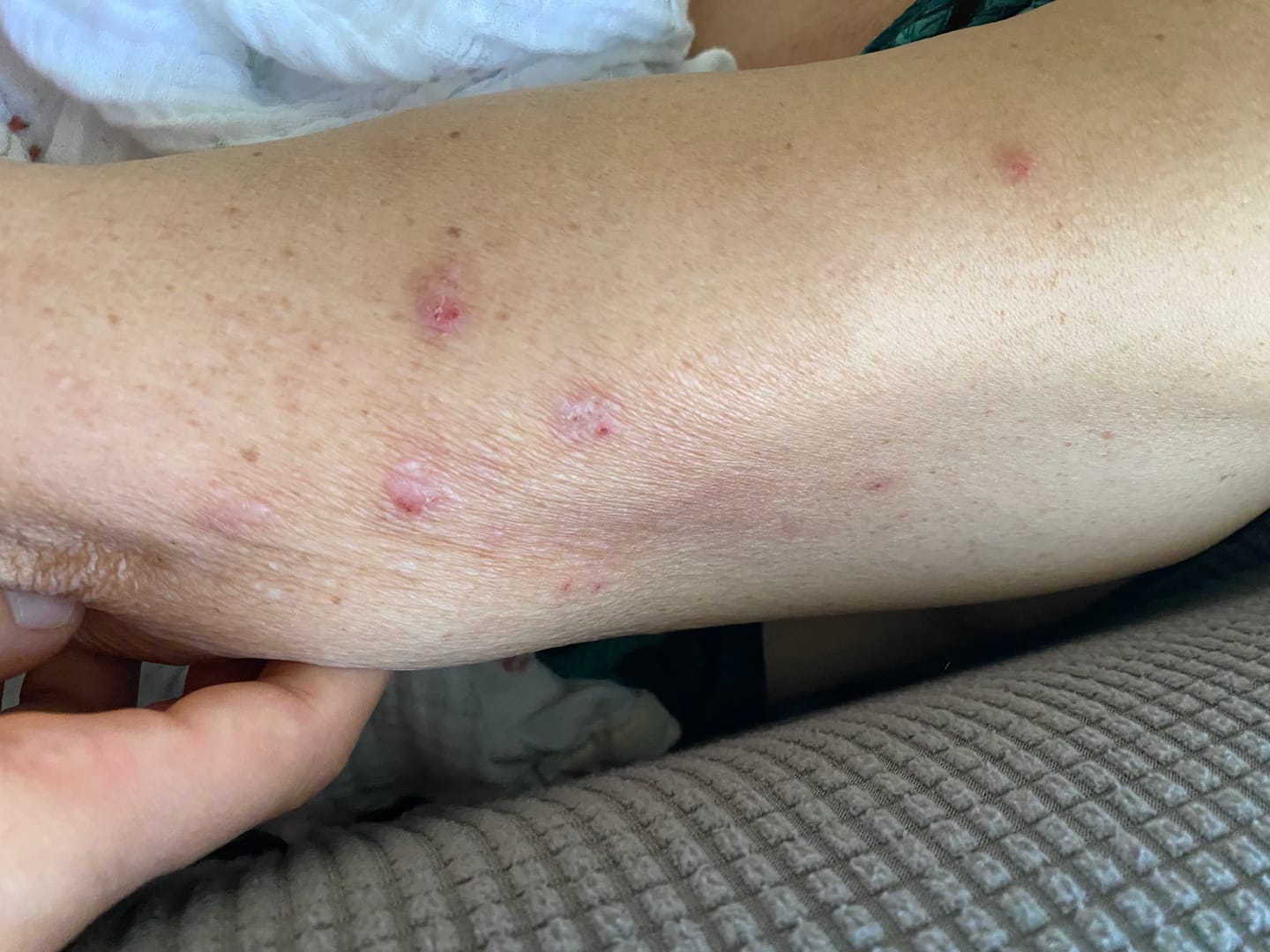 Customer photo review of Healing Salve | CBD