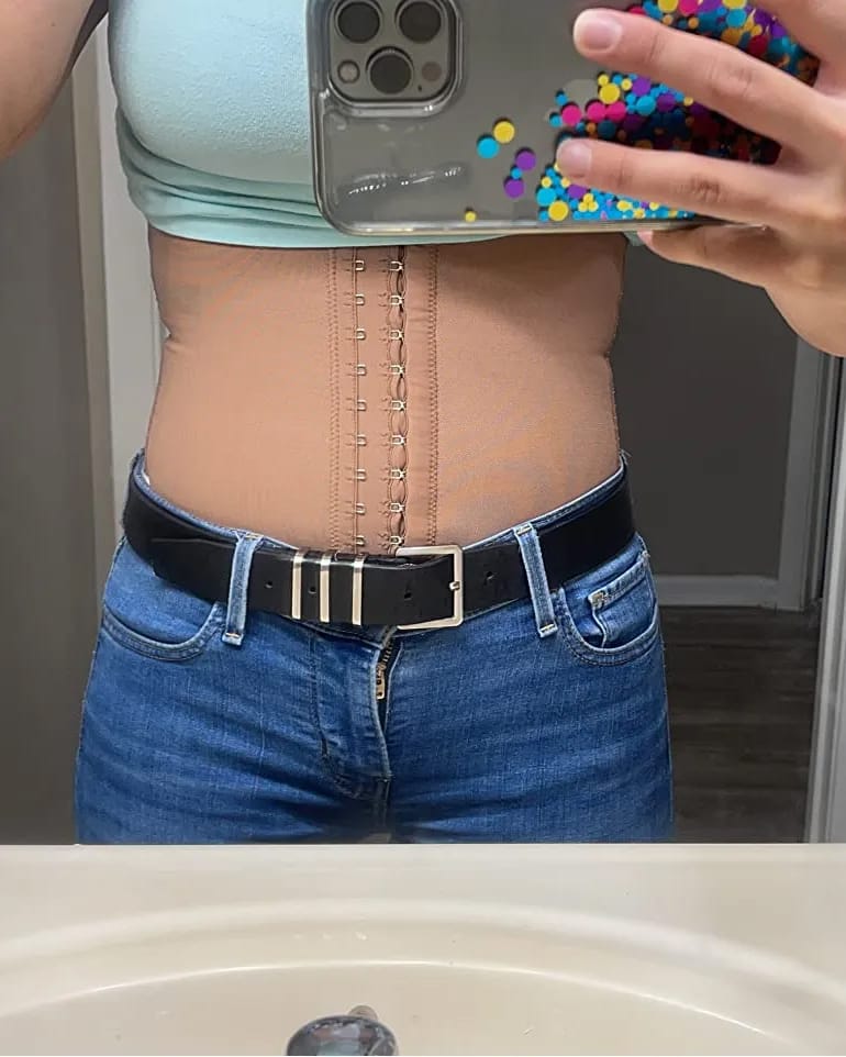 Customer photo review of Body Perfect Silhouette - BodySlim™