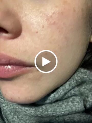 Customer video review of Varita Infinite Glow & Serum Activador