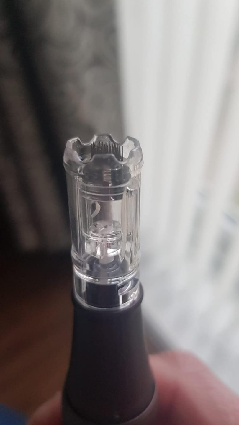 Customer photo review of Dr. Pen A10 *Perfect Skin*