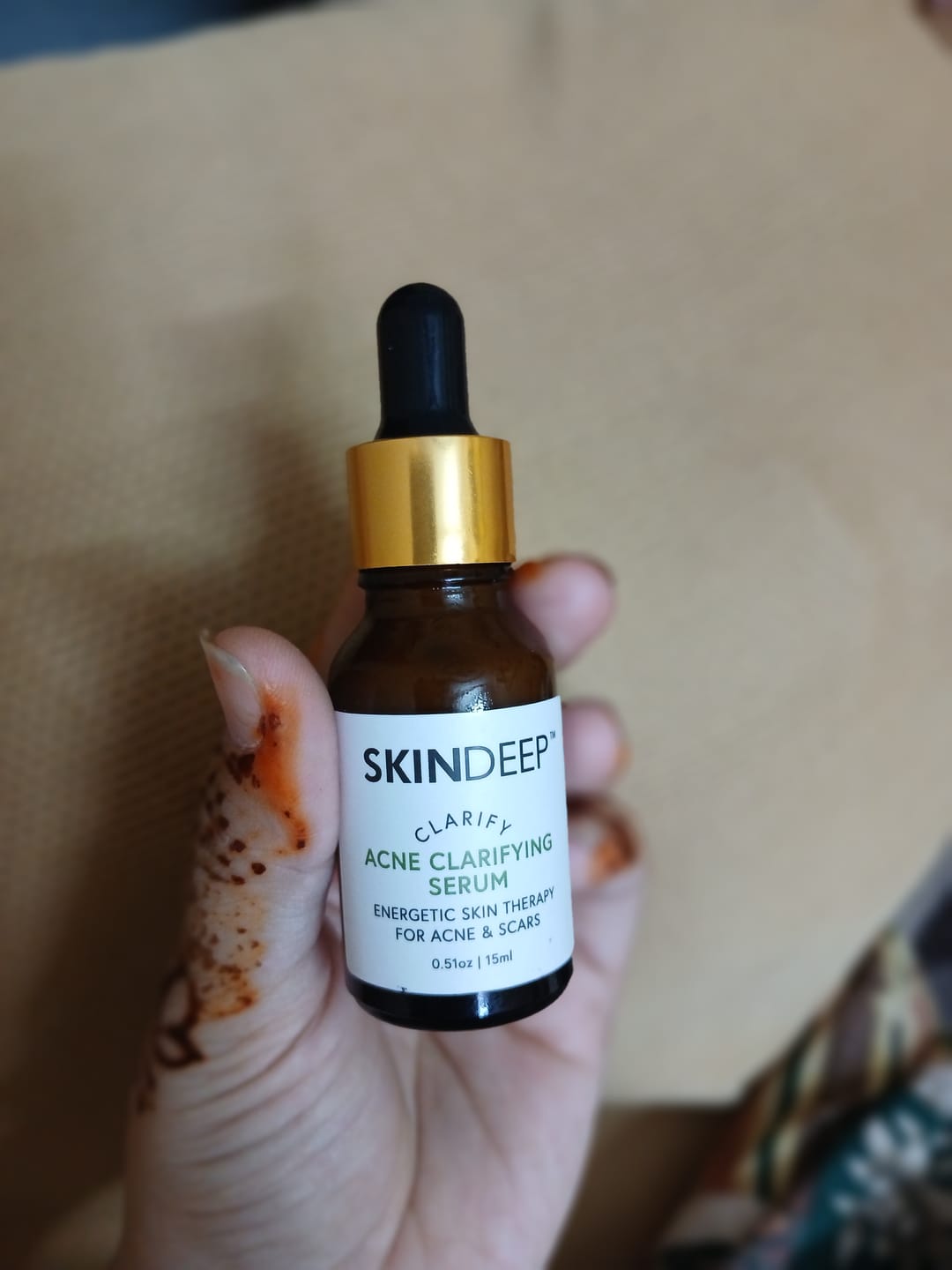 Customer photo review of ACNE CLARIFYING SERUM - Energetic Skin Therapy for Acne & Scars