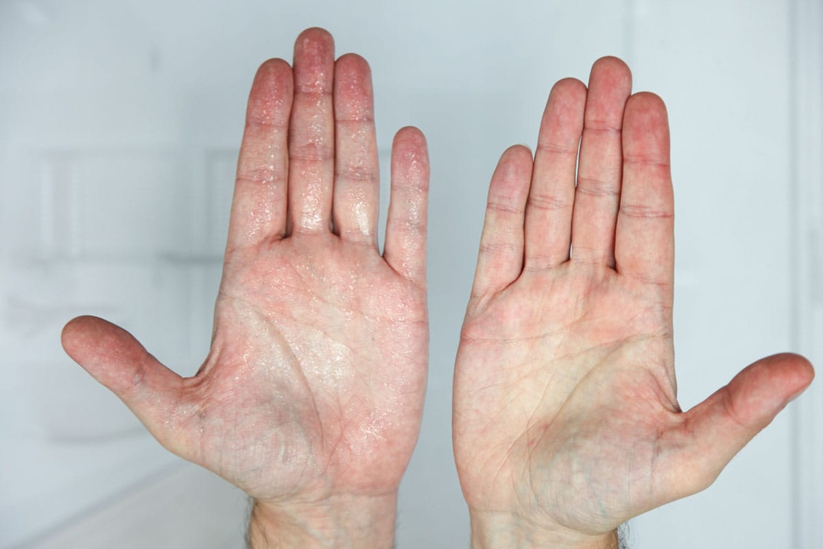Customer photo review of odaban Antitranspirant GEL