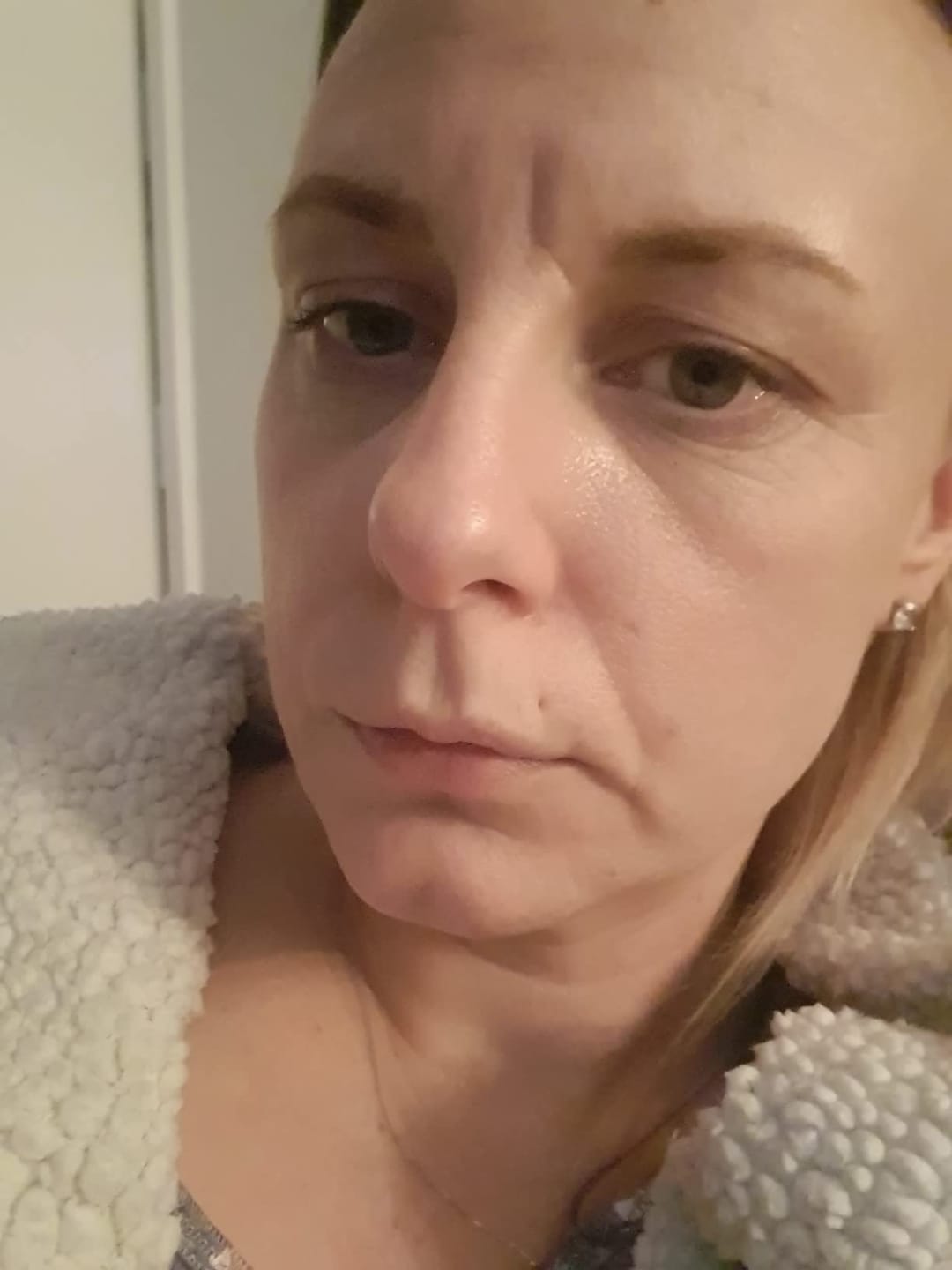 Customer photo review of Dr. Pen A10 *Perfect Skin*