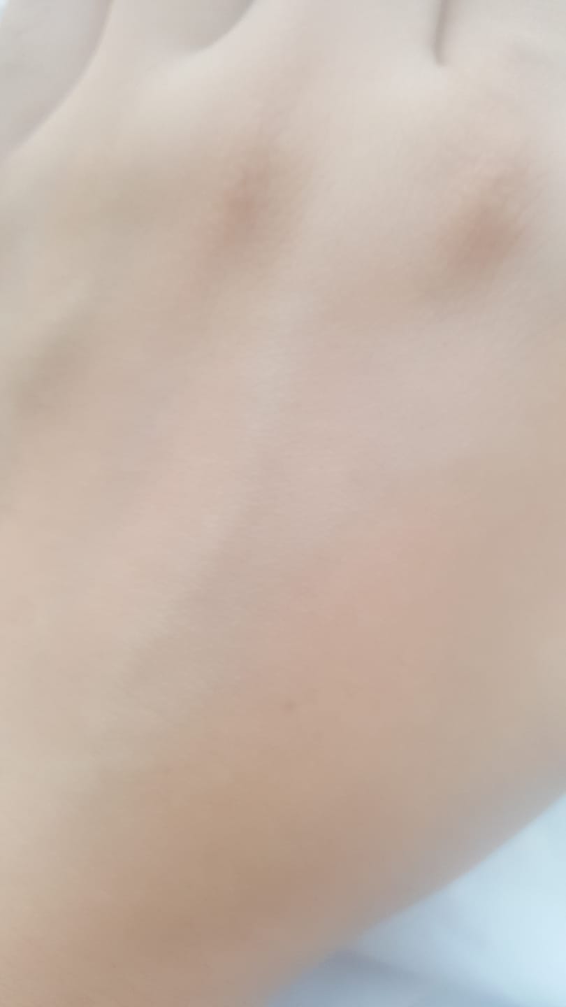 Customer photo review of Bright Berry Facewash
