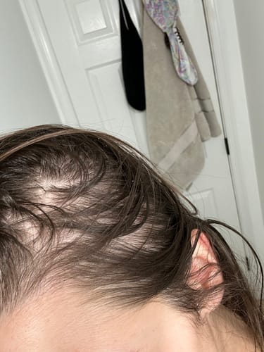 Customer photo review of Pre-Wash Scalp Oil by TR