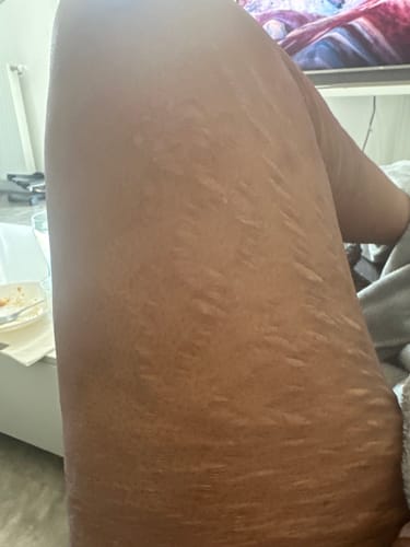 Customer photo review of Peeling savon noir anti vergetures