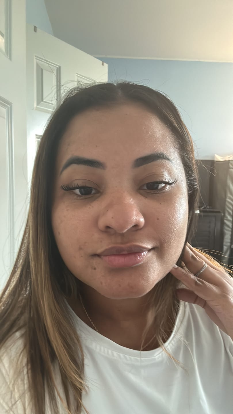 Customer photo review of Luxury Aftercare Kit