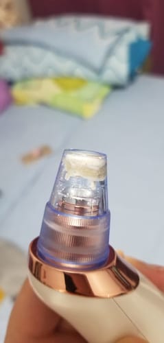 Customer photo review of Extracta™ - Blackheads Remover Vacuum