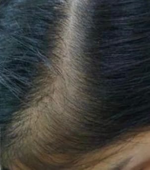 Customer photo review of Dandruff Defence Hair Oil With Rosemary & Olive Oil Extract for Scalp