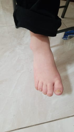 Customer photo review of Yeast Free Goldenseal Salve