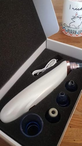 Customer photo review of Extracta™ - Blackheads Remover Vacuum