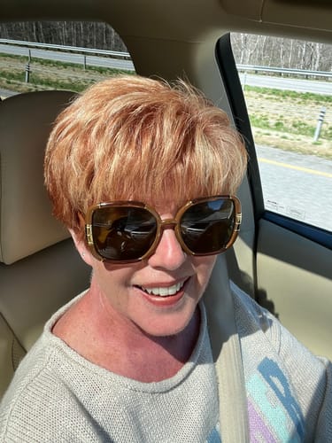 Customer photo review of HA Serum