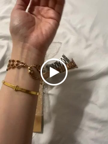 Customer video review of Lynx Cuff