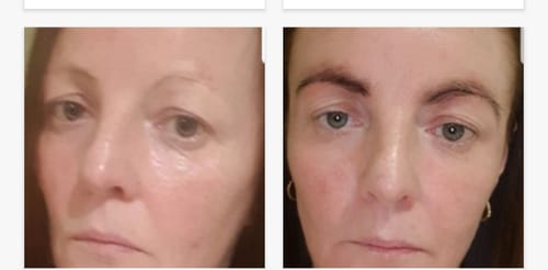 Customer photo review of iGlow Lash Maximizer - Lash Serum, 3 ml