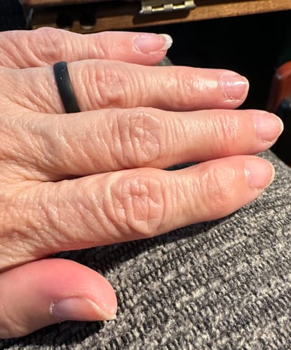 Customer photo review of Rocket Nail Fuel Nail Repair - Purple
