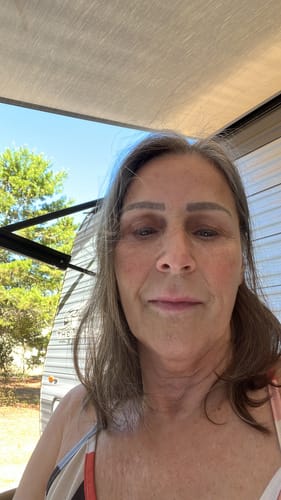 Customer photo review of Face & Neck Firming Duo with Cold Plasma Sub-D+