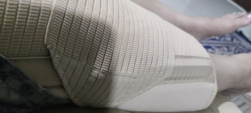 Customer photo review of Knee Brace - Short (14" Brace) | Ideal firm Knee support that limits knee motion & stabilizes the knee with mediolateral metal supports | Color - Beige