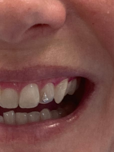 Customer photo review of Droplet w. Diamond White Gold 18-karat