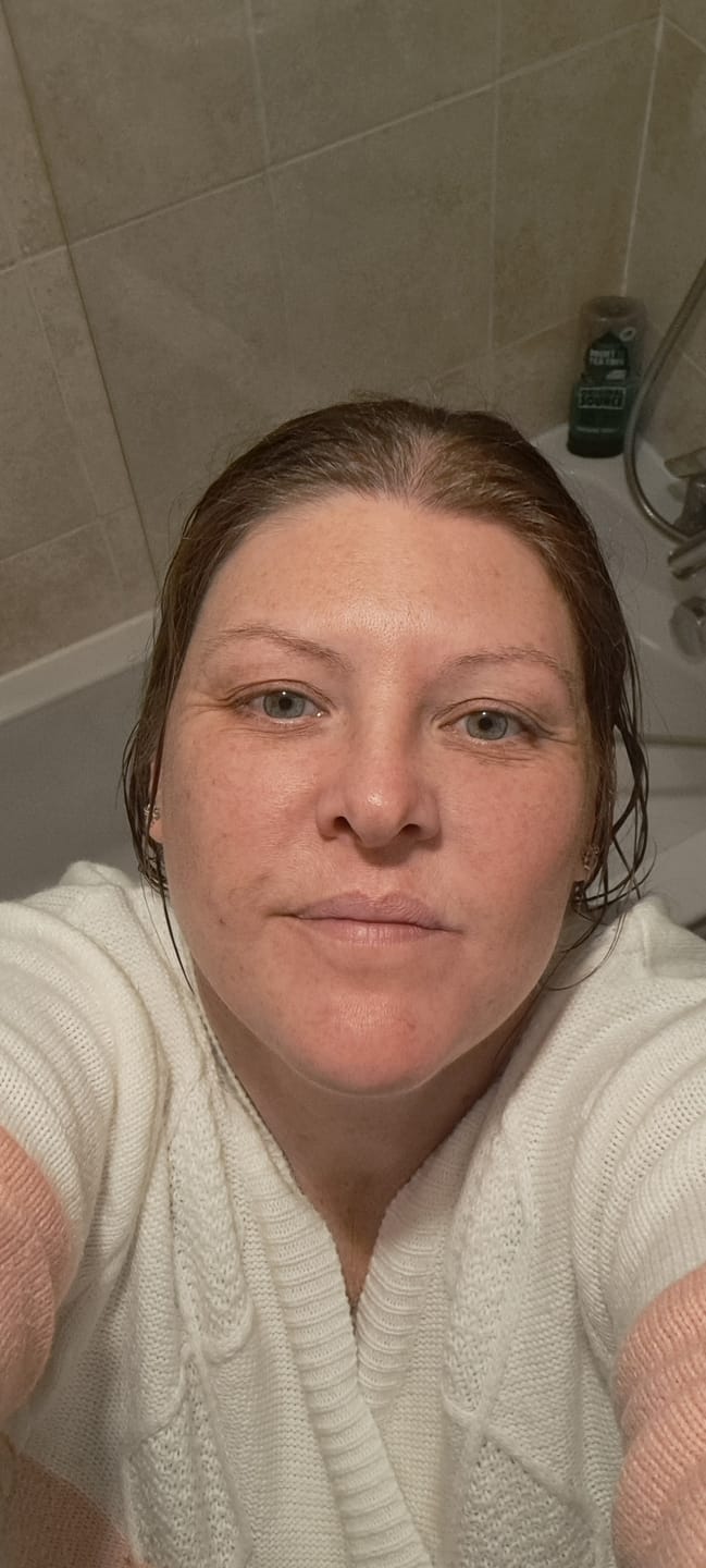 Customer photo review of Youth Boost BioRefill