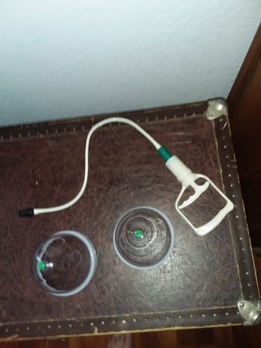 Customer photo review of Breast Cupping System