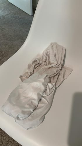 Customer photo review of Eczema Scratch Mitten