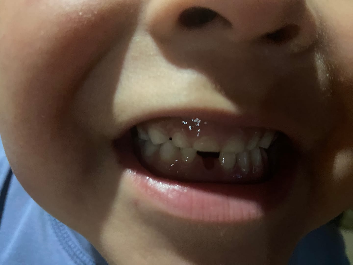 Customer photo review of Caja de dientes Oh my teeth