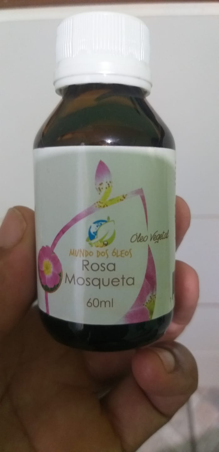 Customer photo review of Óleo de Rosa Mosqueta