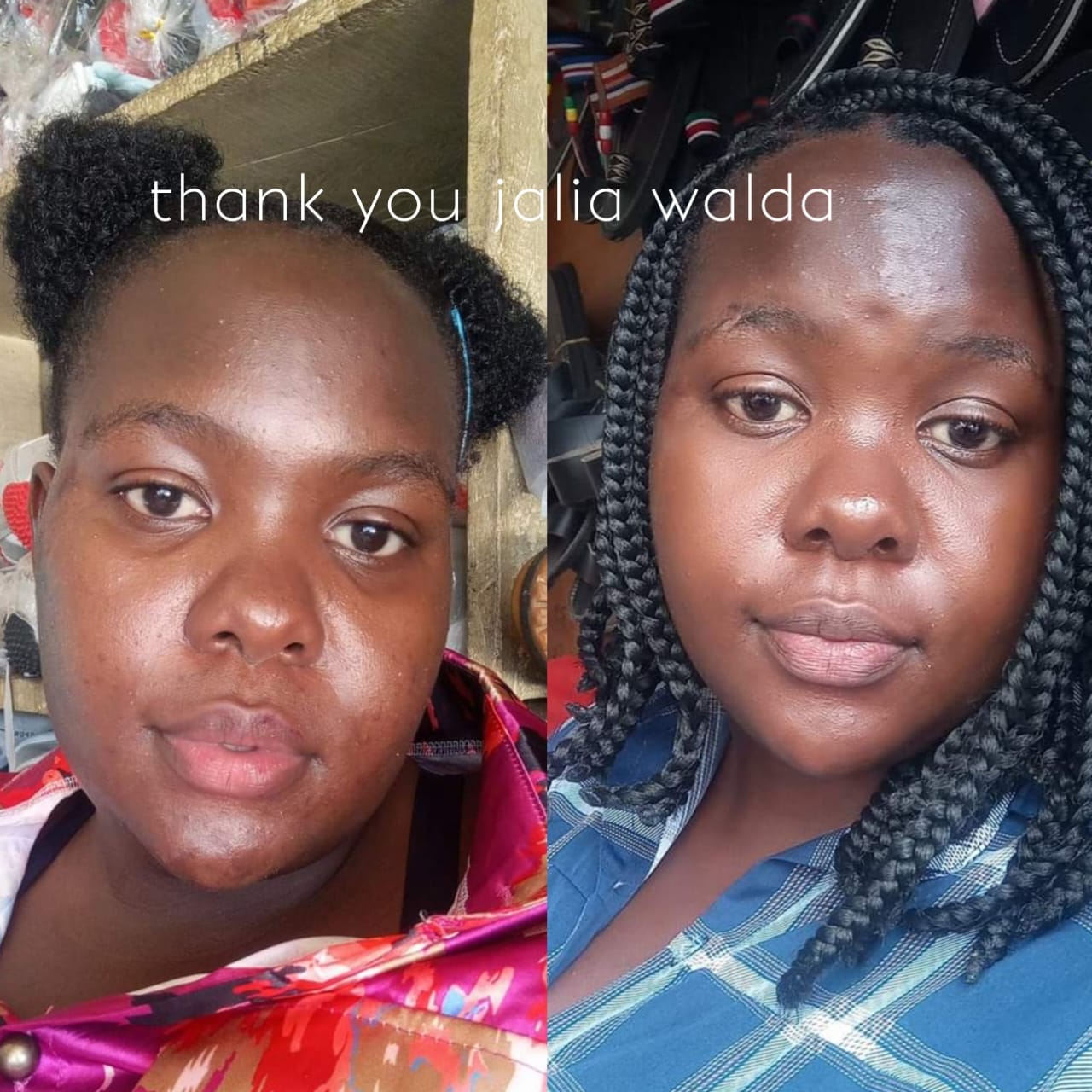 Customer photo review of Dark spots + Glow combo(offer ends today)