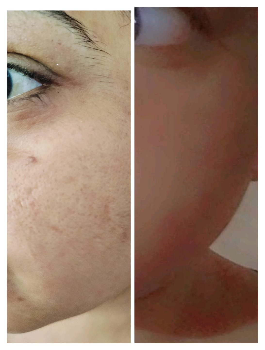 Customer photo review of Luminate Pore Refining Face Wash Gel