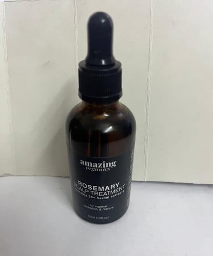 Customer photo review of Rosemary Scalp Treatment