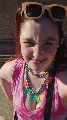 Customer photo review of Stardust Speckles + Faux Freckles Makeup Patches