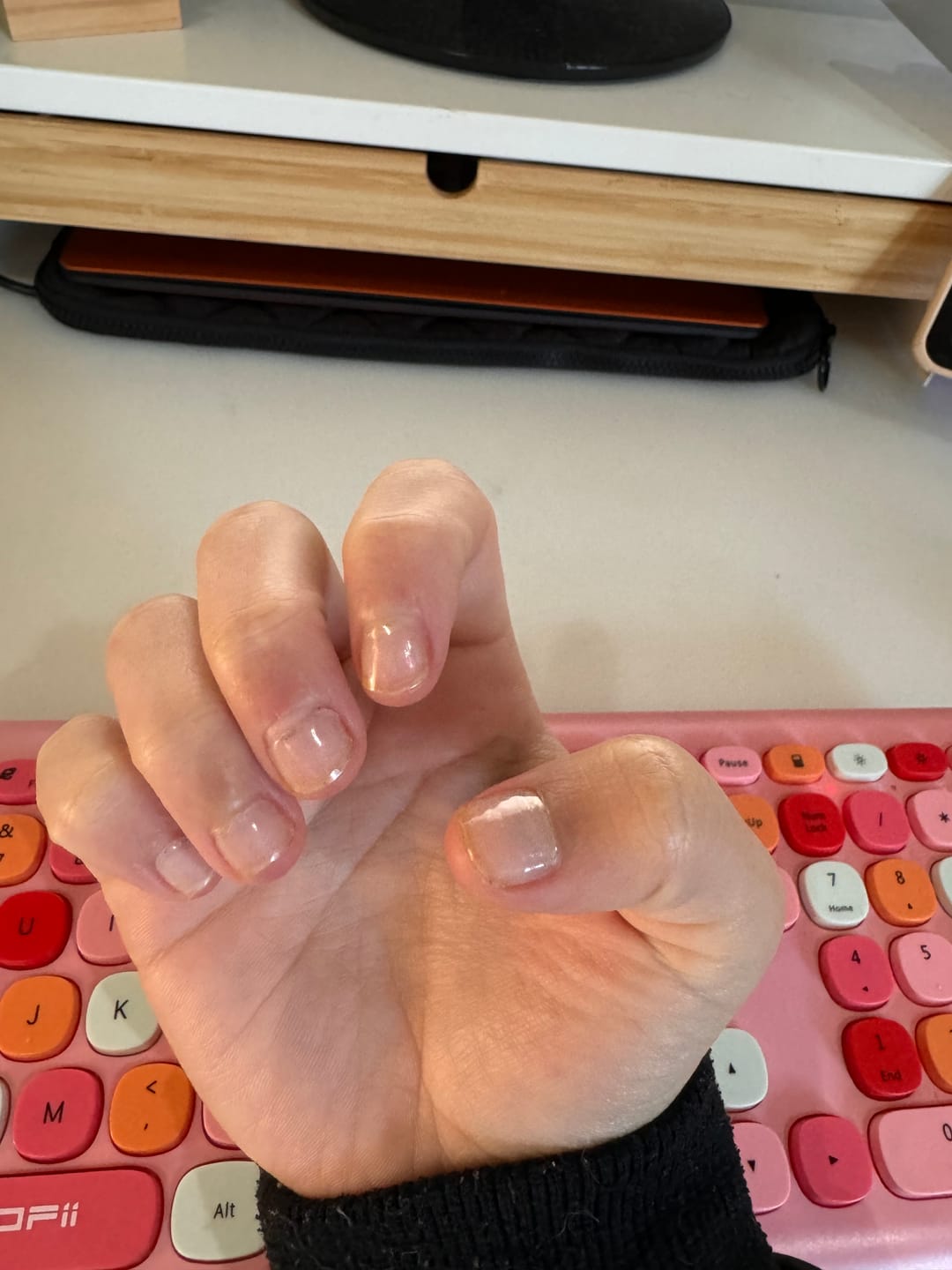 Customer photo review of Crystal Clear DIY Semicured Gel Nail Sticker Kit (STOP NAIL BITING & GROW BRITTLE NAILS)