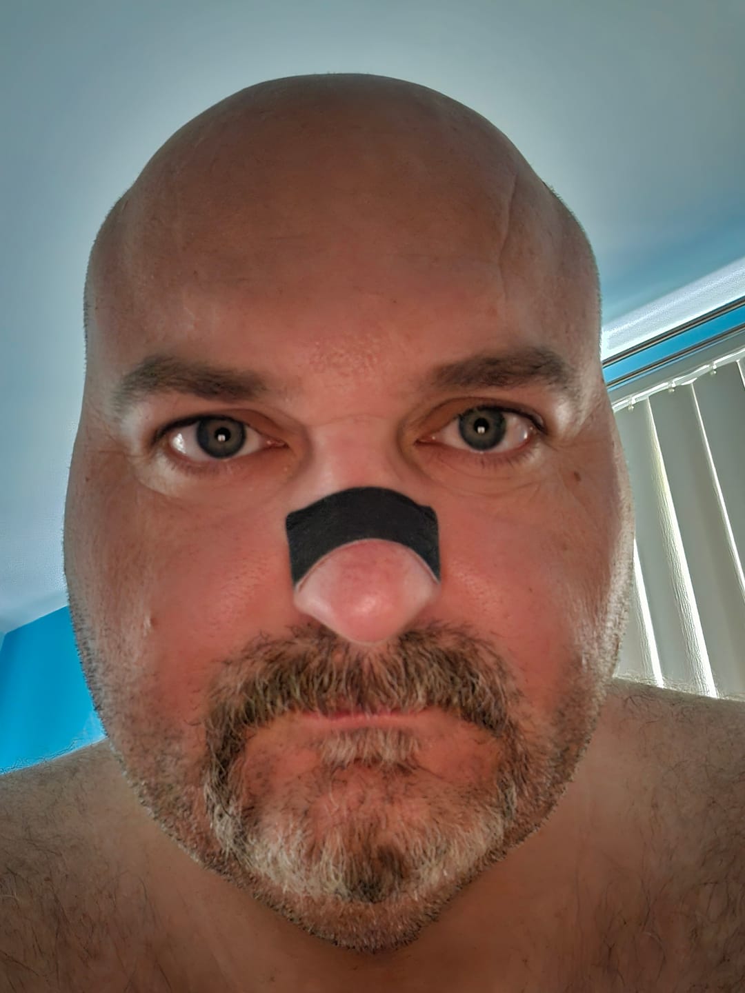 Customer photo review of Hostage Nose Strips