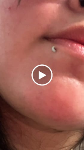 Customer video review of Crescent Moon Top Titanium Flatback Ring