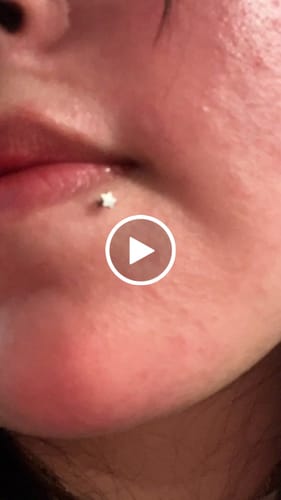 Customer video review of Star Top Titanium Flatback Ring