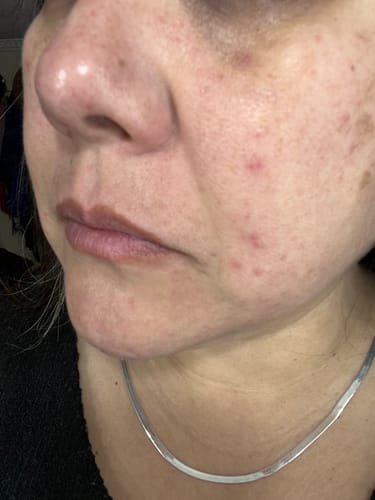 Customer photo review of Emulsión Recuperadora
