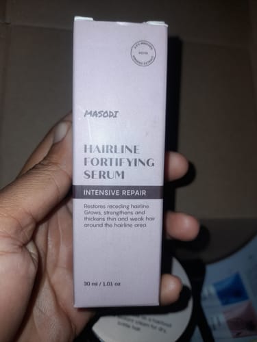 Customer photo review of Hairline Fortifying Serum 30ml