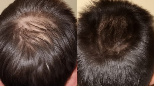 Customer photo review of Hair Health Melts (CC)