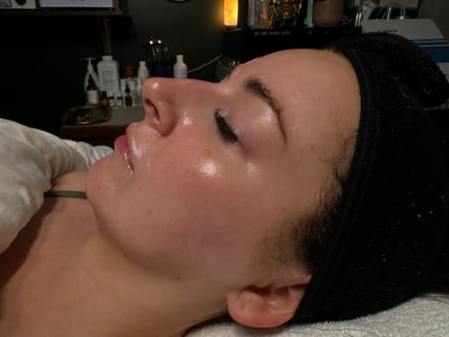 Customer photo review of The CryoPeptide 20 Pack
