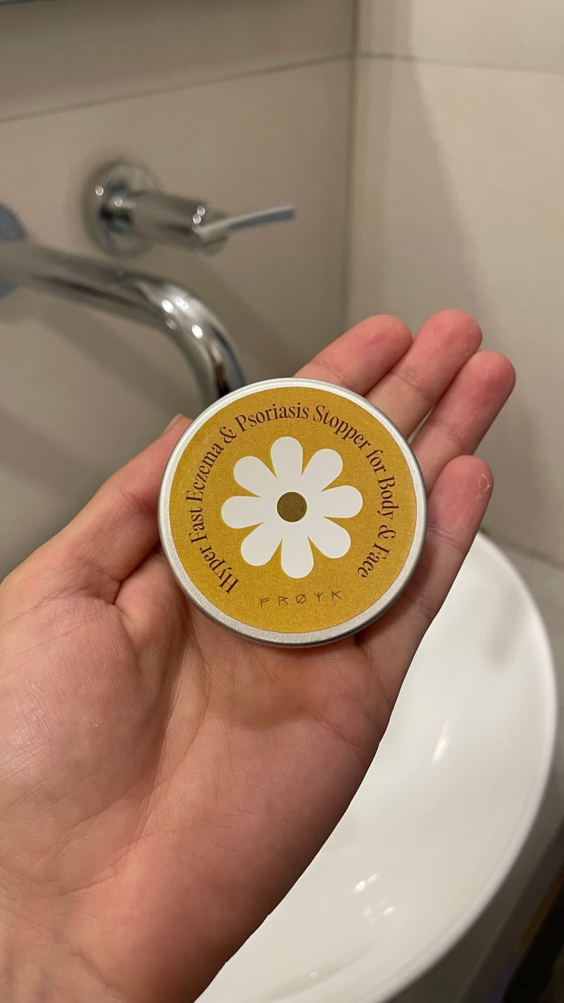 Customer photo review of Ultra-Fast Relief Balm for Dry, Itchy Skin – For Body & Face