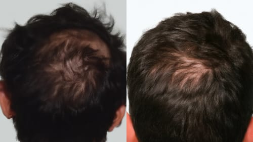 Customer photo review of Hair Health Melts (CC)