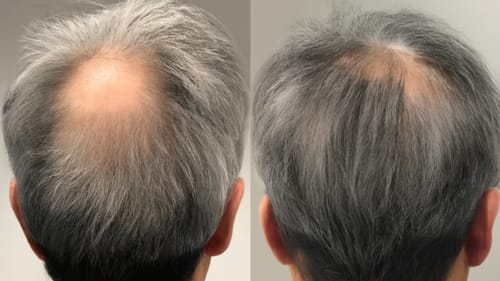 Customer photo review of Hair Health Melts (CC)